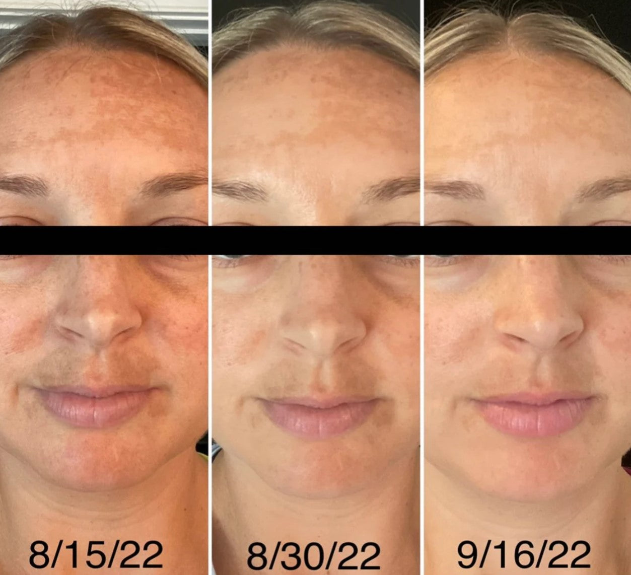 Beef Tallow Moisturizer Blend